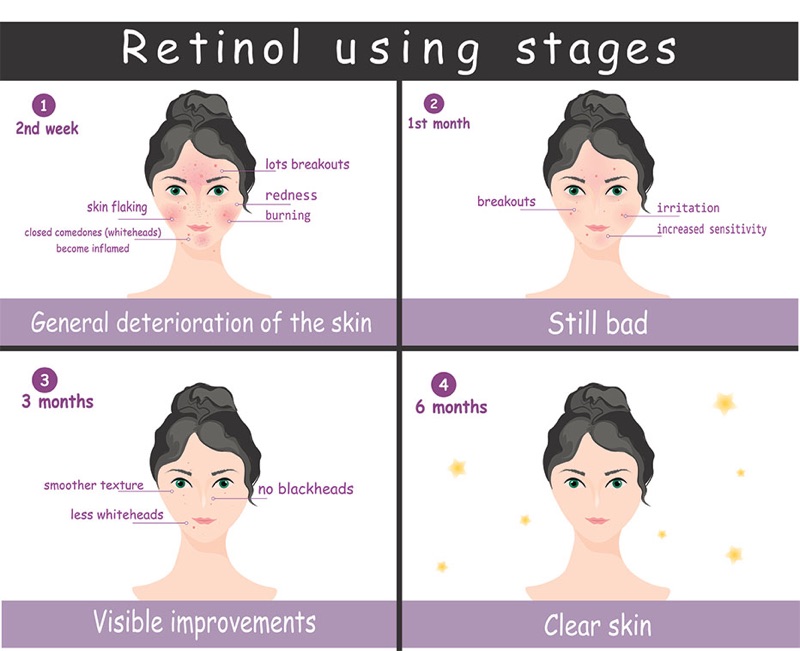 Stages of how Retinol works on your skin