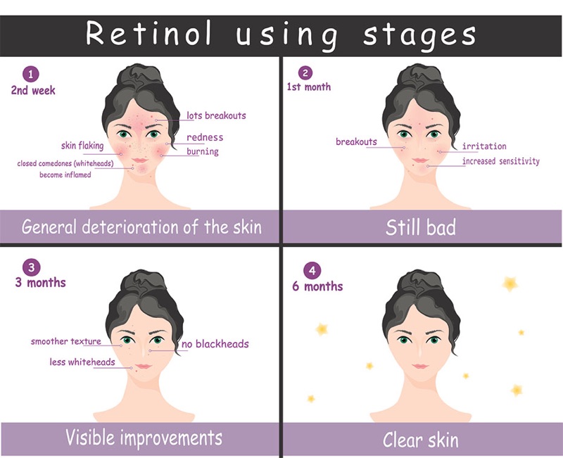 Working stages of Retinol on the skin in a diagram form