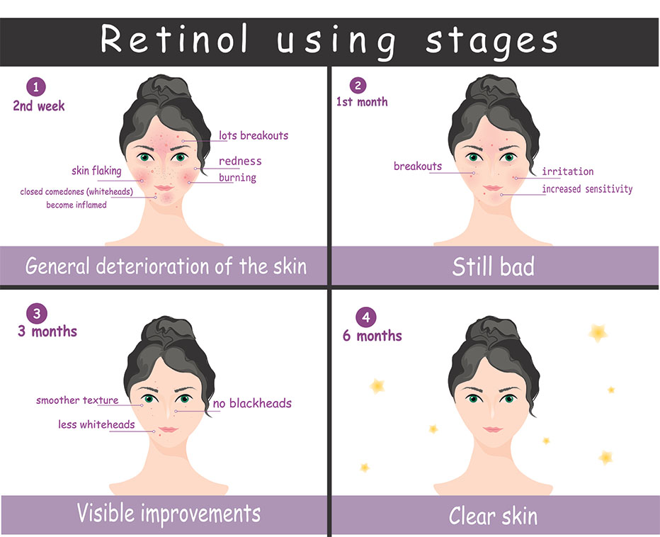 Diagram showing impact of retinol usage over months